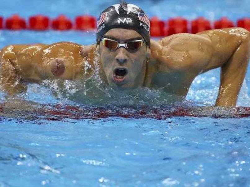 Rio Olympics: Why Does Michael Phelps Have Purple Spots on His Back?