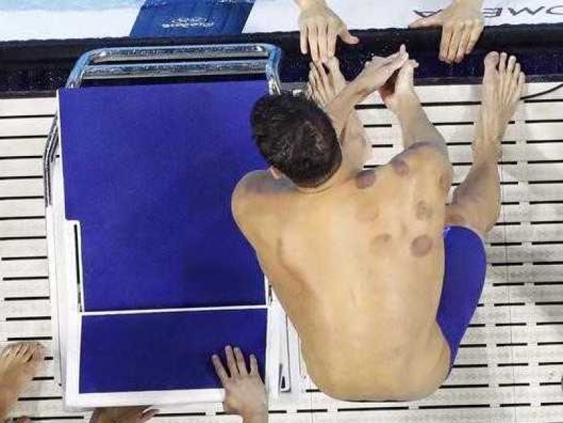 Rio Olympics: Cup Half Full For Vampire Victim Michael Phelps